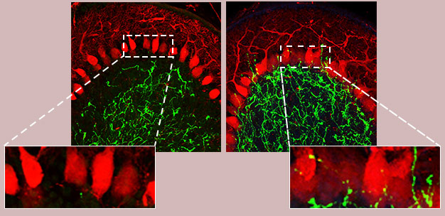 Sections of the cerebellum in mice show that when the cell-surface protein Cadherin-7 (Cdh7) is expressed (left), pontine nucleus (PN) neurons (green) do not connect to Purkinje cells (red). However, reducing levels of Cdh7 in PN neurons (right) causes abundant connection of PN axons to Purkinje cells.