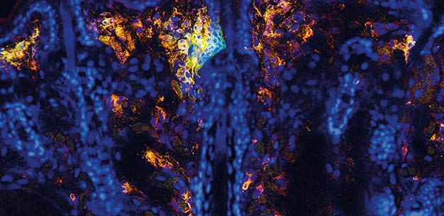 Skin dendritic cells (orange and green) accumulate around hair follicles (blue nuclear staining) in mice.