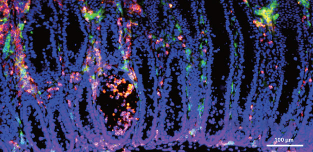 Disrupting the epigenetic regulation of regulatory T cells in the intestinal lining of mice causes inflammation, shown by the green fluorescent markers.