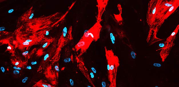 Human heart muscle cells (red) generated from fibroblasts by direct reprogramming.