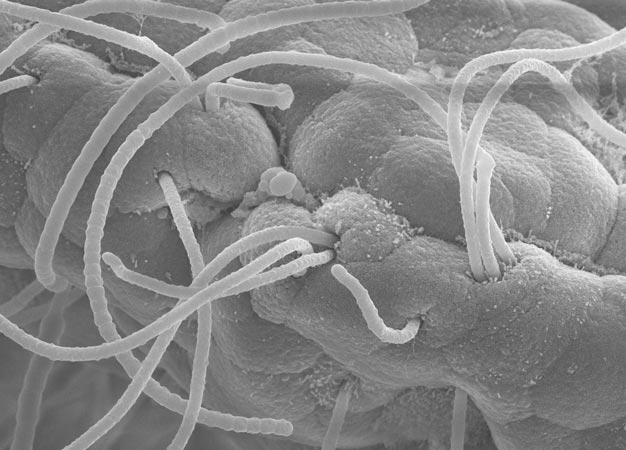 Electron micrograph of sticky segmented filamentous bacteria (long strands) attached to epithelial cells.