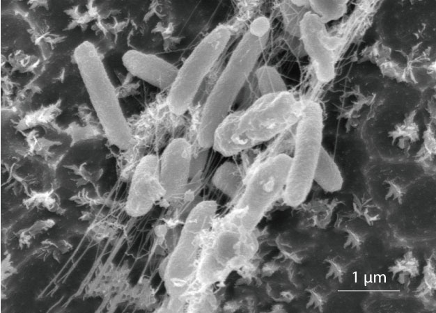 The bacterium Idoenella sakaiensis feeds on plastic bottles for energy and carbon.