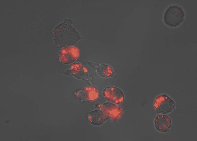 Stimuli-responsive fluorescent polymers light up to reveal the temperature inside cells.