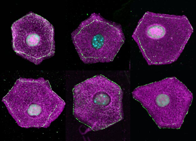 The 14-sided tetrakaidecahedron shape of epidermal cells (seen here from different angles) explains how the skin maintains a physical barrier against disease.