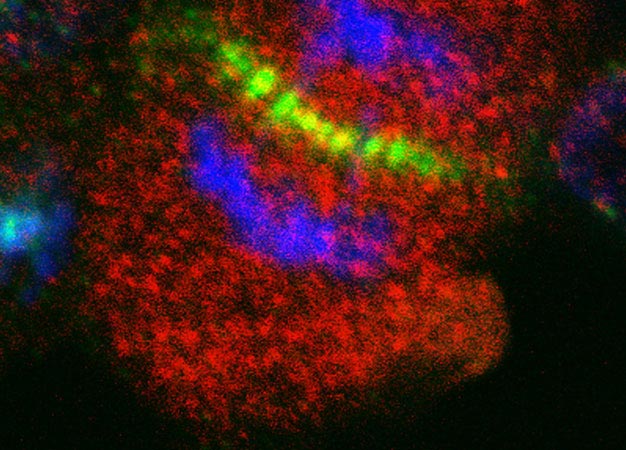 Fluorescence imaging of aurora kinase inhibitor-resistant cells reveals that aurora kinase B (green) and AKT3 (red) overlap at the center of the cell during cell division. The blue label indicates chromosomes.