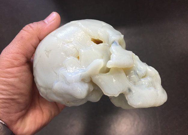 A half-size, three-dimensional printed restoration model of a Shiraho skull.