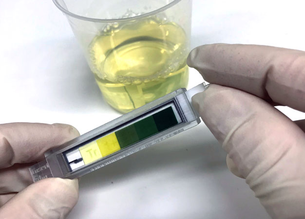 Reading the results of home urine tests can be challenging. Daniel Citterio and his team have developed a system that makes it much easier to interpret results.